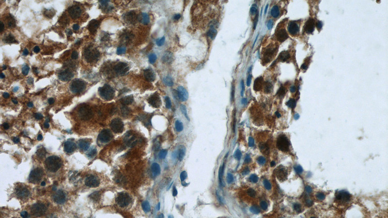 Immunohistochemistry of paraffin-embedded human testis tissue slide using Catalog No:113102(NEK2 Antibody) at dilution of 1:50 (under 40x lens)