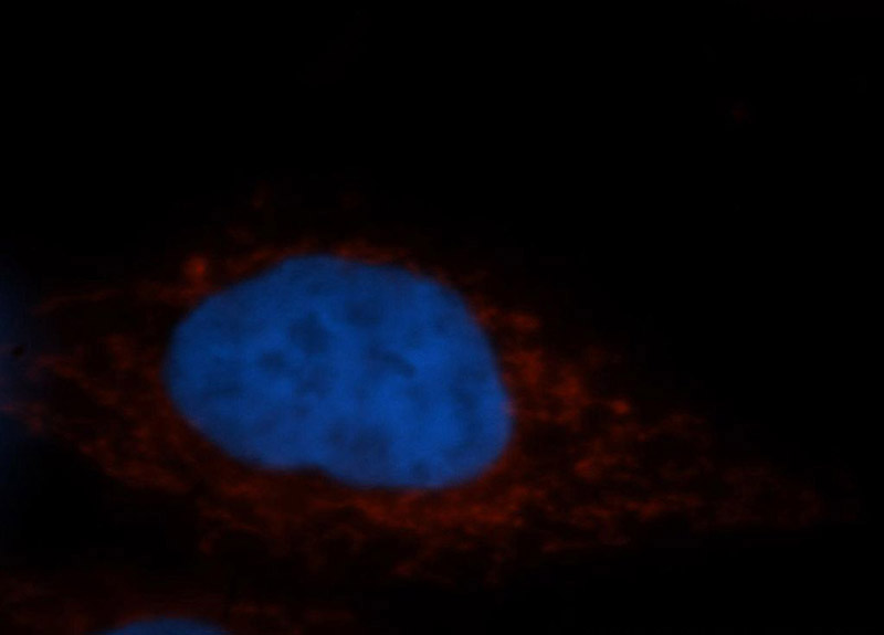 Immunofluorescent analysis of MCF-7 cells, using STOML2 antibody Catalog No:115731 at 1:50 dilution and Rhodamine-labeled goat anti-rabbit IgG (red). Blue pseudocolor = DAPI (fluorescent DNA dye).