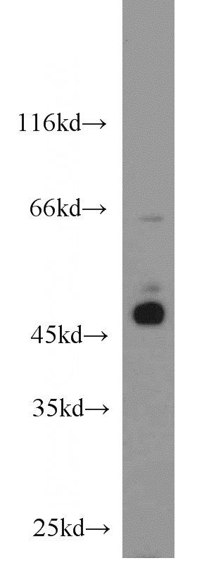 HeLa cells were subjected to SDS PAGE followed by western blot with Catalog No:108384(BCCIP antibody) at dilution of 1:800