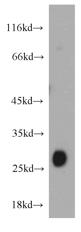 mouse liver tissue were subjected to SDS PAGE followed by western blot with Catalog No:116088(TMED9 antibody) at dilution of 1:500