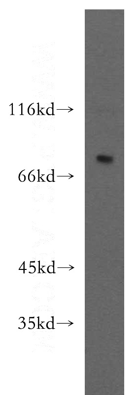 PC-3 cells were subjected to SDS PAGE followed by western blot with Catalog No:110071(DPP8 antibody) at dilution of 1:300