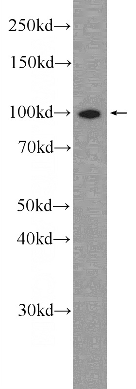A431 cells were subjected to SDS PAGE followed by western blot with Catalog No:113158(NFKB2,p52,p100-Specific Antibody) at dilution of 1:600