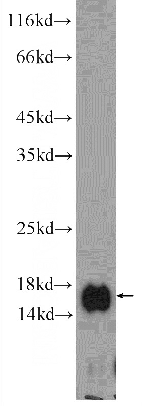 A431 cells were subjected to SDS PAGE followed by western blot with Catalog No:108826(CALML3 Antibody) at dilution of 1:300