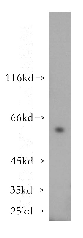 Jurkat cells were subjected to SDS PAGE followed by western blot with Catalog No:112945(NAP1L1 antibody) at dilution of 1:500