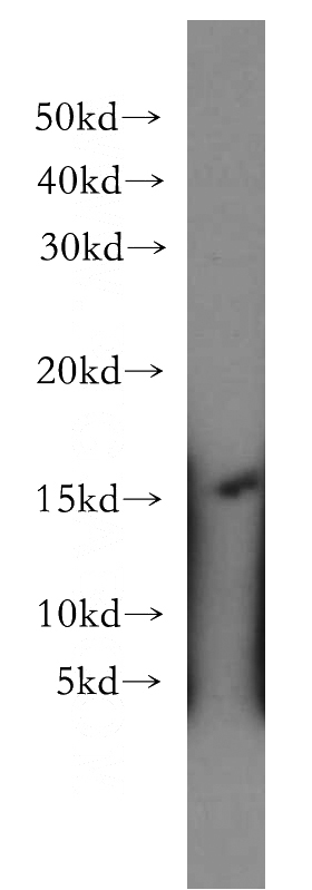 Raji cells were subjected to SDS PAGE followed by western blot with Catalog No:112227(LIMD2 antibody) at dilution of 1:300