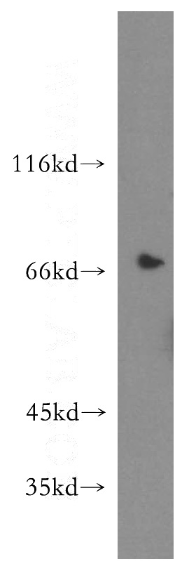 HepG2 cells were subjected to SDS PAGE followed by western blot with Catalog No:115351(SLC9A9 antibody) at dilution of 1:300