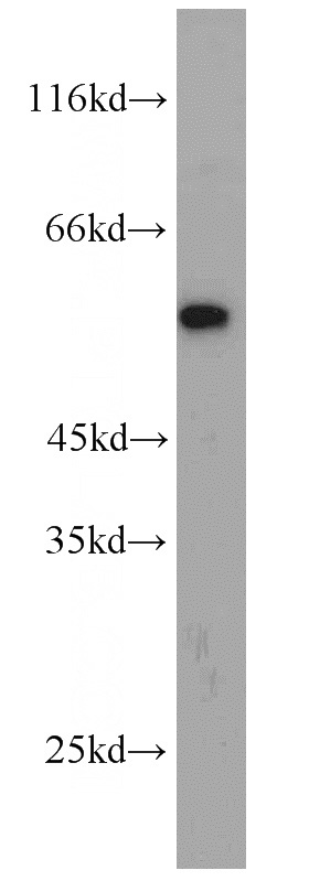 mouse skeletal muscle tissue were subjected to SDS PAGE followed by western blot with Catalog No:112996(MYOT antibody) at dilution of 1:300