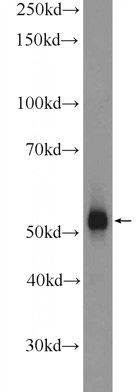 mouse testis tissue were subjected to SDS PAGE followed by western blot with Catalog No:109872(DAZ4 Antibody) at dilution of 1:600