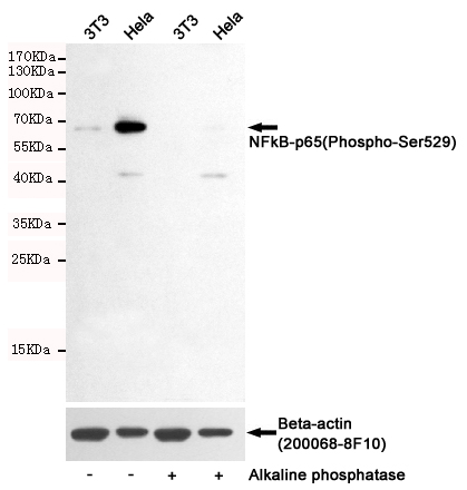 Western blot detection of NFkB-p65(Phospho-Ser529) in 3T3 and Hela cells untreated or treated with Alkaline phosphatase using NFkB-p65(Phospho-Ser529) Rabbit pAb (dilution 1:500, upper) or u03b2-Actin Mouse mAb (200068-8F10, lower).Predicted band size:65kDa.Observed band size:65kDa.