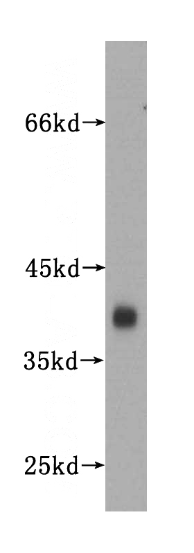 human brain tissue were subjected to SDS PAGE followed by western blot with Catalog No:115768(SYP antibody) at dilution of 1:1500