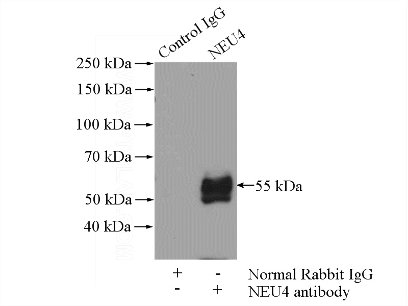 IP Result of anti-NEU4 (IP:Catalog No:113119, 4ug; Detection:Catalog No:113119 1:500) with L02 cells lysate 1400ug.