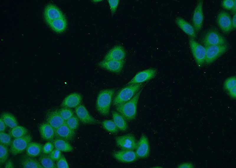Immunofluorescent analysis of HeLa cells using Catalog No:115092(SECISBP2 Antibody) at dilution of 1:50 and Alexa Fluor 488-congugated AffiniPure Goat Anti-Rabbit IgG(H+L)