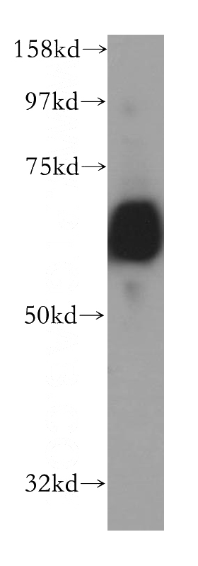 mouse kidney tissue were subjected to SDS PAGE followed by western blot with Catalog No:109577(CROT antibody) at dilution of 1:1500