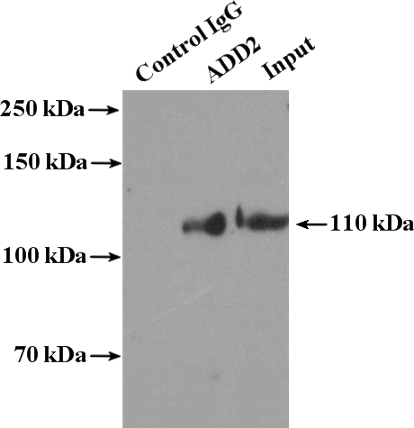 IP Result of anti-ADD2 (IP:Catalog No:117124, 4ug; Detection:Catalog No:117124 1:1000) with K-562 cells lysate 3200ug.