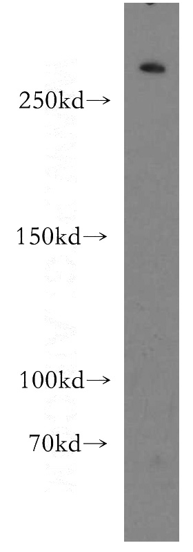 human brain tissue were subjected to SDS PAGE followed by western blot with Catalog No:111396(HECTD1 antibody) at dilution of 1:500
