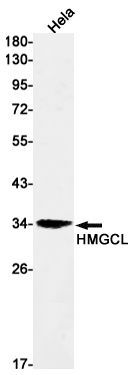 Western blot detection of HMGCL in Hela cell lysates using HMGCL Rabbit mAb(1:1000 diluted).Predicted band size:34kDa.Observed band size:34kDa.