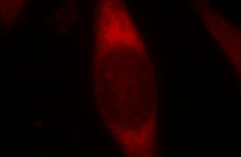 Immunofluorescent analysis of Hela cells, using PDZD2 antibody Catalog No:113643 at 1:25 dilution and Rhodamine-labeled goat anti-rabbit IgG (red).
