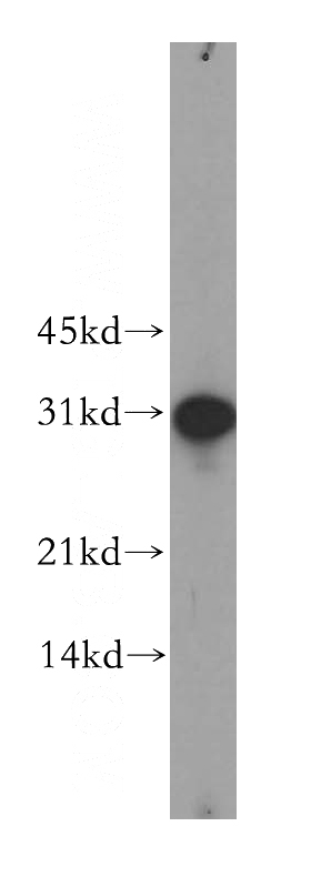 mouse ovary tissue were subjected to SDS PAGE followed by western blot with Catalog No:110984(GJB3 antibody) at dilution of 1:1000