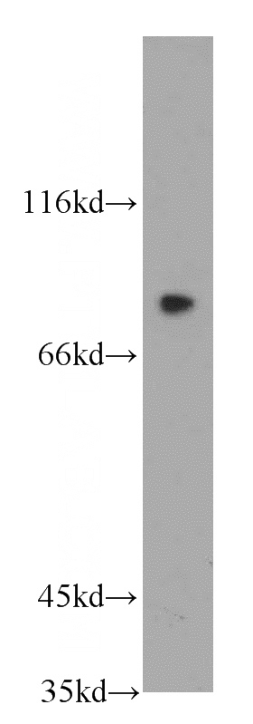 human brain tissue were subjected to SDS PAGE followed by western blot with Catalog No:112333(LRRC41 antibody) at dilution of 1:100
