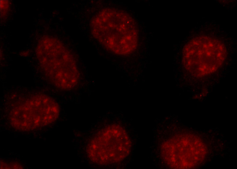 Immunofluorescent analysis of HeLa cells using Catalog No:108613(C17orf85 Antibody) at dilution of 1:25 and Rhodamine-Goat anti-Rabbit IgG