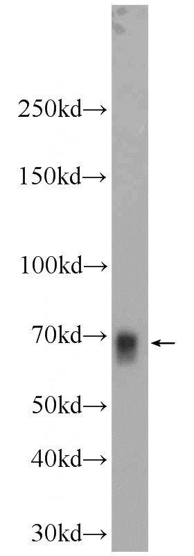 HEK-293 cells were subjected to SDS PAGE followed by western blot with Catalog No:113145(NFE2L1 Antibody) at dilution of 1:600