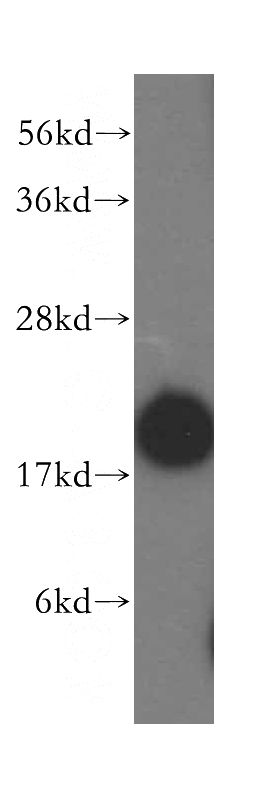 mouse thymus tissue were subjected to SDS PAGE followed by western blot with Catalog No:116510(UBC9 antibody) at dilution of 1:500