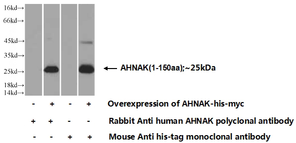 Transfected HEK-293 cells were subjected to SDS PAGE followed by western blot with Catalog No:107845(AHNAK Antibody) at dilution of 1:1000