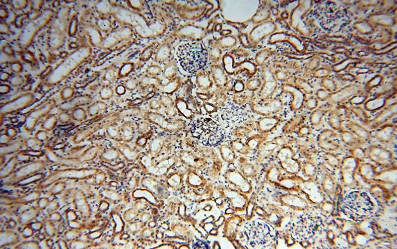 Immunohistochemical of paraffin-embedded human kidney using Catalog No:116598(USP20 antibody) at dilution of 1:50 (under 10x lens)