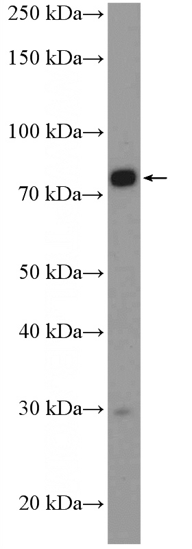 COLO 320 cells were subjected to SDS PAGE followed by western blot with Catalog No:115344(SLC5A11 Antibody) at dilution of 1:300