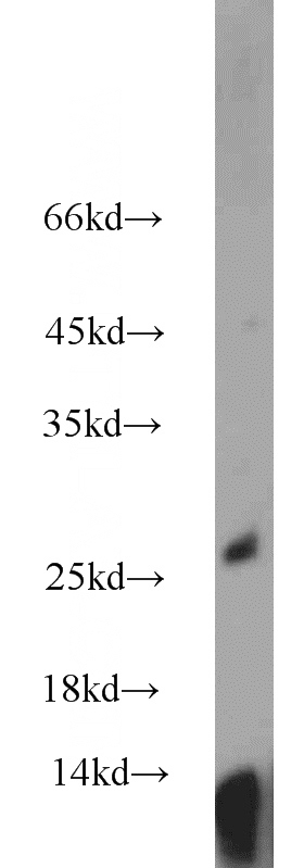 PC-3 cells were subjected to SDS PAGE followed by western blot with Catalog No:116735(VEGFA antibody) at dilution of 1:800