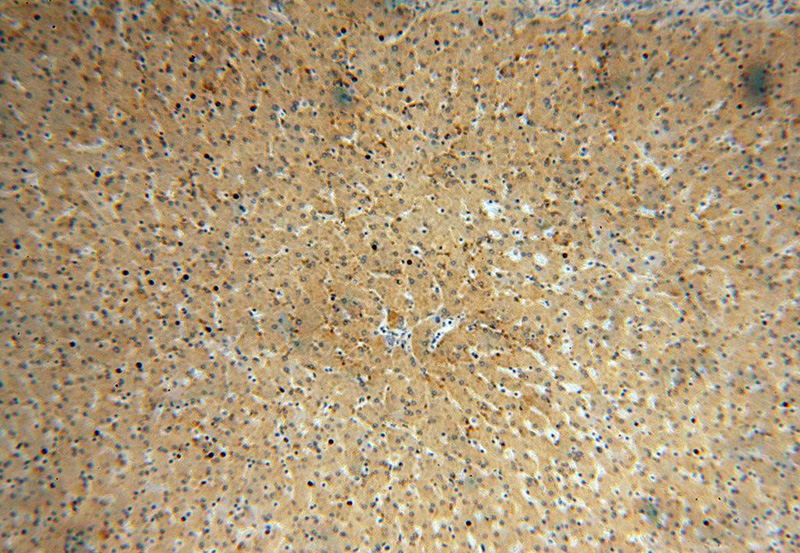 Immunohistochemical of paraffin-embedded human liver using Catalog No:112522(METTL7B antibody) at dilution of 1:100 (under 10x lens)