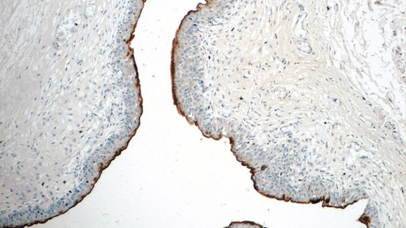 Immunohistochemistry of paraffin-embedded human bladder tissue slide using Catalog No:116630(UPK2-Specific Antibody) at dilution of 1:200 (under 10x lens)
