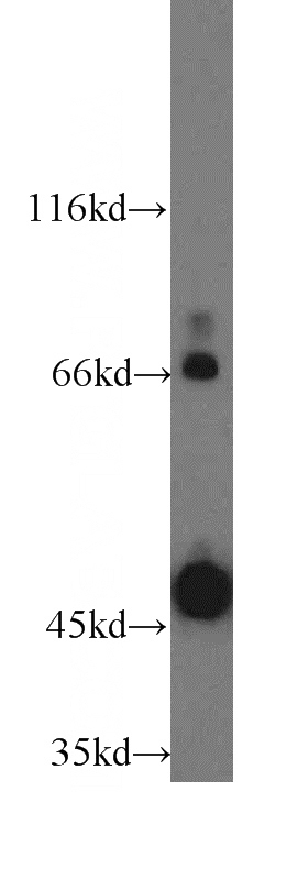 Raji cells were subjected to SDS PAGE followed by western blot with Catalog No:109142(CD84 antibody) at dilution of 1:3000