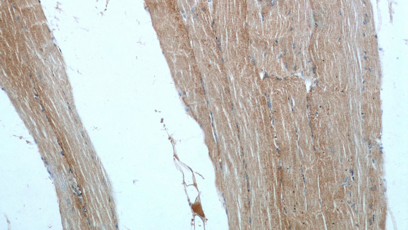 Immunohistochemical of paraffin-embedded human skeletal muscle using Catalog No:112425(MAP4K3 antibody) at dilution of 1:100 (under 10x lens)