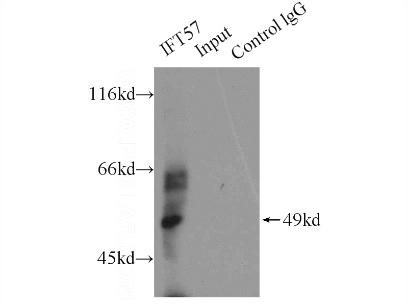 IP Result of anti-IFT57 (IP:Catalog No:111670, 5ug; Detection:Catalog No:111670 1:800) with HEK-293 cells lysate 2000ug.