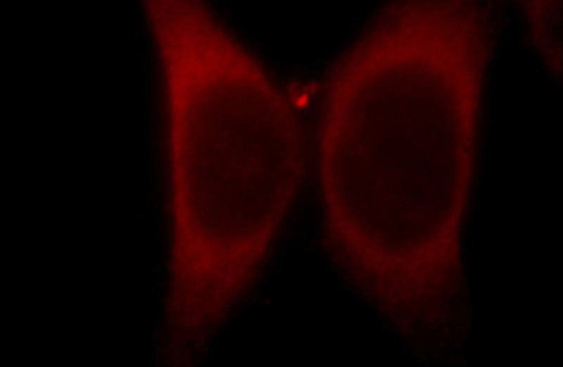 Immunofluorescent analysis of HepG2 cells, using SLC39A8 antibody Catalog No:117062 at 1:25 dilution and Rhodamine-labeled goat anti-rabbit IgG (red).