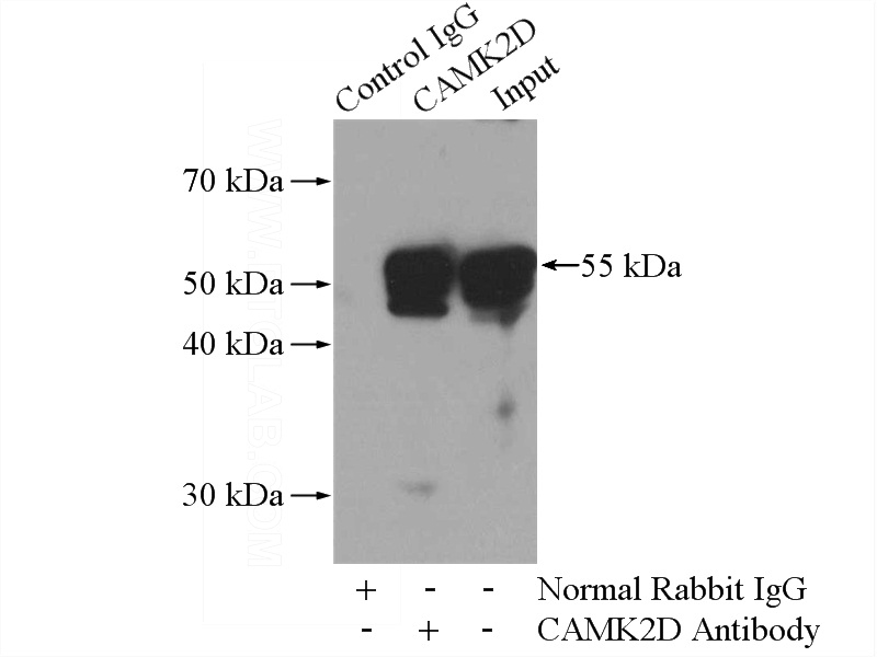 IP Result of anti-CAMK2D-Specific (IP:Catalog No:108919, 4ug; Detection:Catalog No:108919 1:600) with rat brain tissue lysate 4000ug.