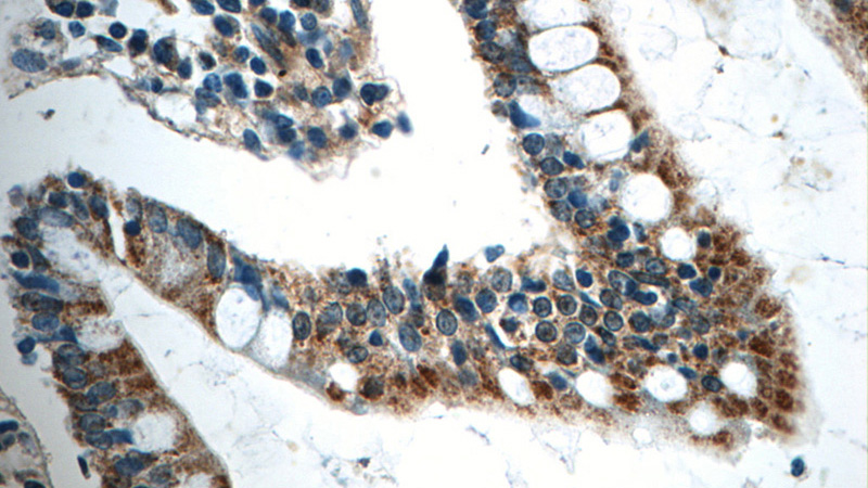 Immunohistochemistry of paraffin-embedded human small intestine tissue slide using Catalog No:109307(CIAO1 Antibody) at dilution of 1:50 (under 40x lens)