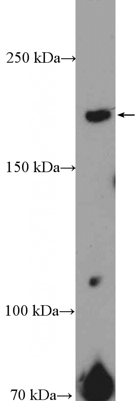 mouse testis tissue were subjected to SDS PAGE followed by western blot with Catalog No:115282(SHPRH Antibody) at dilution of 1:300