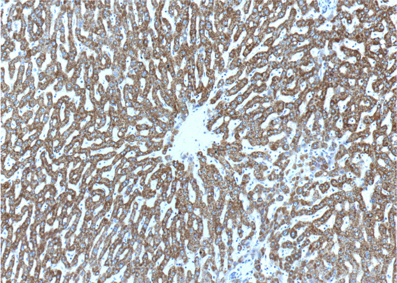 Immunohistochemistry of paraffin-embedded human liver tissue slide using Catalog No:111314(HGS Antibody) at dilution of 1:200 (under 10x lens).