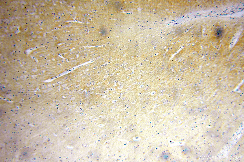 Immunohistochemical of paraffin-embedded human brain using Catalog No:117256(SLC30A3 antibody) at dilution of 1:100 (under 10x lens)