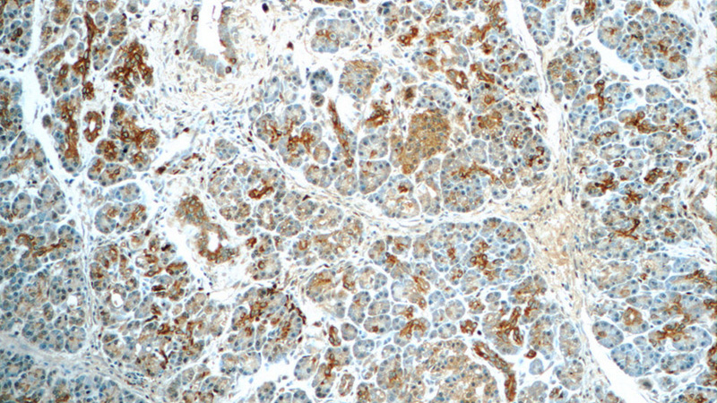 Immunohistochemistry of paraffin-embedded human pancreas tissue slide using Catalog No:115200(SERPINB10 Antibody) at dilution of 1:50 (under 10x lens)