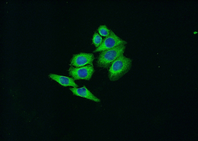 Immunofluorescent analysis of HeLa cells using Catalog No:112792(MTOR Antibody) at dilution of 1:50 and Alexa Fluor 488-congugated AffiniPure Goat Anti-Rabbit IgG(H+L)