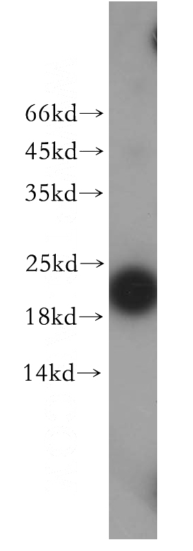 SGC-7901 cells were subjected to SDS PAGE followed by western blot with Catalog No:110506(EXOSC1 antibody) at dilution of 1:200