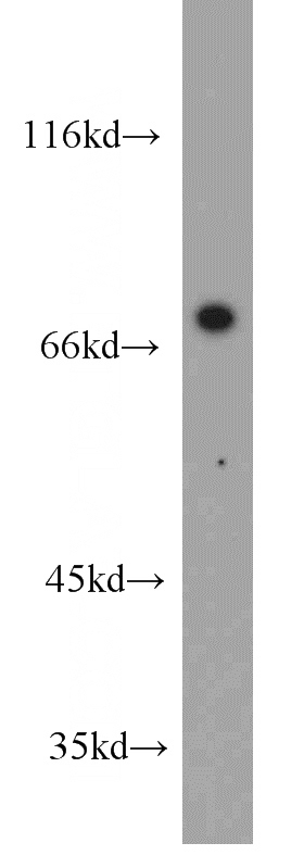 Jurkat cells were subjected to SDS PAGE followed by western blot with Catalog No:112709(MMP9 antibody) at dilution of 1:500