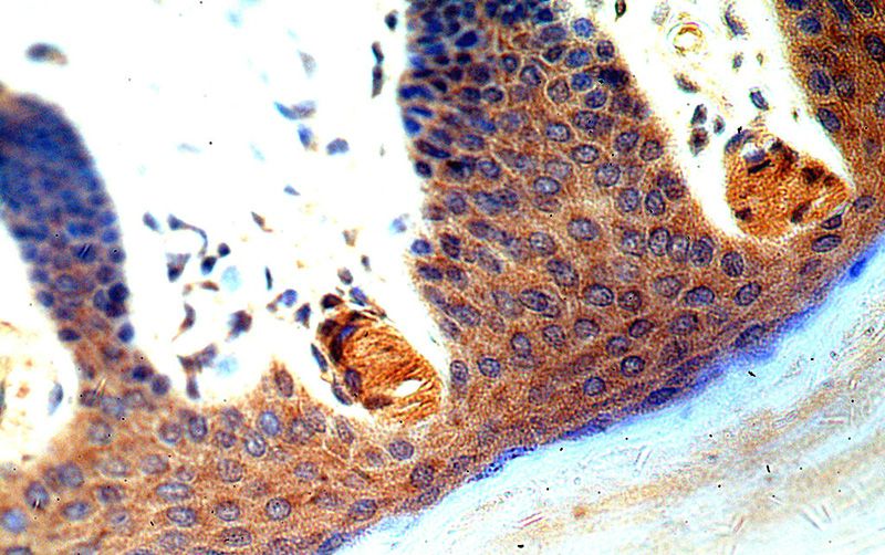 Immunohistochemical of paraffin-embedded human skin using Catalog No:111166(GSDMD antibody) at dilution of 1:50 (under 40x lens)