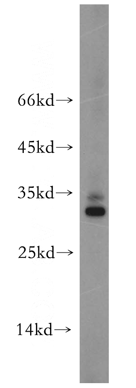 mouse brain tissue were subjected to SDS PAGE followed by western blot with Catalog No:115097(SCG5 antibody) at dilution of 1:2000