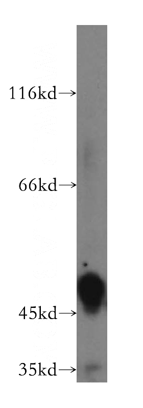 human liver tissue were subjected to SDS PAGE followed by western blot with Catalog No:111313(HGD antibody) at dilution of 1:500