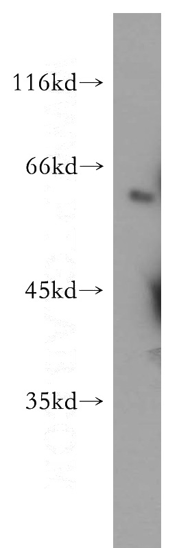 HeLa cells were subjected to SDS PAGE followed by western blot with Catalog No:115168(SGK3 antibody) at dilution of 1:300