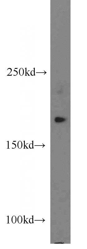 PC-3 cells were subjected to SDS PAGE followed by western blot with Catalog No:114093(PPP1R9A antibody) at dilution of 1:300